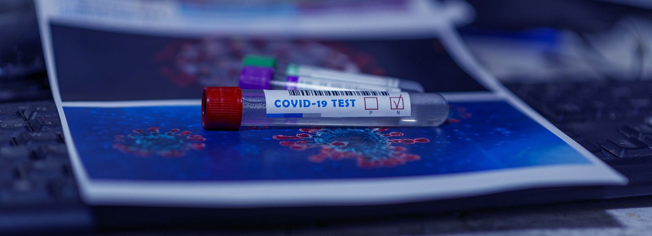 Read more about the article CDC will require a Covid test for entry into the U.S.